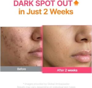 Purito Txa 6 Niacinamide 10 Retinal Serum