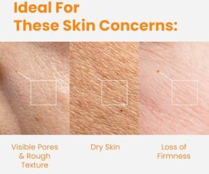 Sıkılaştırıcı Kolajen Içeren Mikro Spikül Iğneli Esans Wati For Skin Lifting Microshot 100