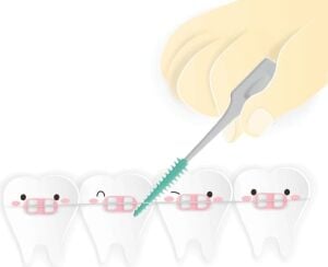 Stopever Well Tooth Arayüz Fırçası – 40 Adet | Naneli Ferahlık & Seyahat Çantası Hediyeli