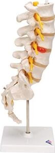 3b Scientific A76/5 Bel Omurga Sütunu, Dorso-Lateral Prolapsed Intervertebral Disk, 34 cm Yükseklik