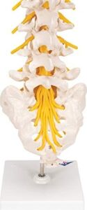 3b Scientific A76/5 Bel Omurga Sütunu, Dorso-Lateral Prolapsed Intervertebral Disk, 34 cm Yükseklik
