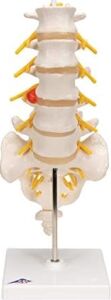3b Scientific A76/5 Bel Omurga Sütunu, Dorso-Lateral Prolapsed Intervertebral Disk, 34 cm Yükseklik