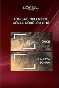 Komple Direnç Dökülme Karşıtı Bakım Kremi 250ML