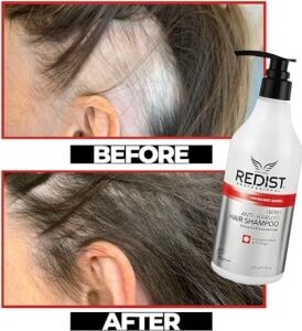 Anti Hairloss Saç Bakım Şampuanı 500 ml 16.90 Fl.oz