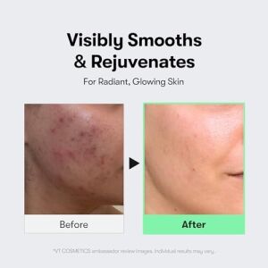 Vt Cosmetics Reedle Shot 100