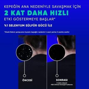 &shoulders Clinical Strength Cooling Itch Rescue Kaşıntı Karşıtı Şampuan 400 ml