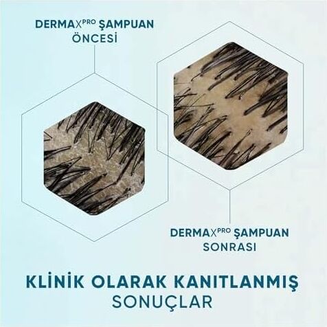 & Shoulders Dermaxpro Yatıştırıcı Kepek Karşıtı Şampuan Kuru ve Kaşıntılı Saç Derisi Için 300 ml