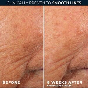 Roc Retinol Correxion Smoothing Kırışıklık Karşıtı Kapsül Serum 10 Adet